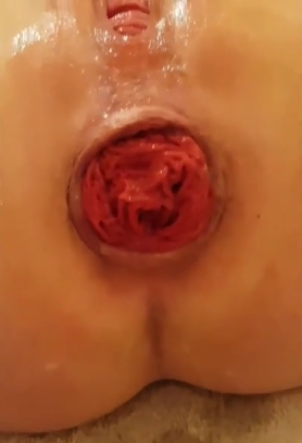 Violet Buttercup Extreme Anal Fisting, Gaping and Rosebutt